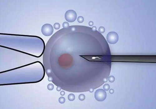 2022南通第三代試管嬰兒價格多少？