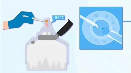 2020年下半年去試管嬰兒價格是多少？